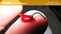 《医院专家提醒红虫钓鱼怎么回事?》封面图
